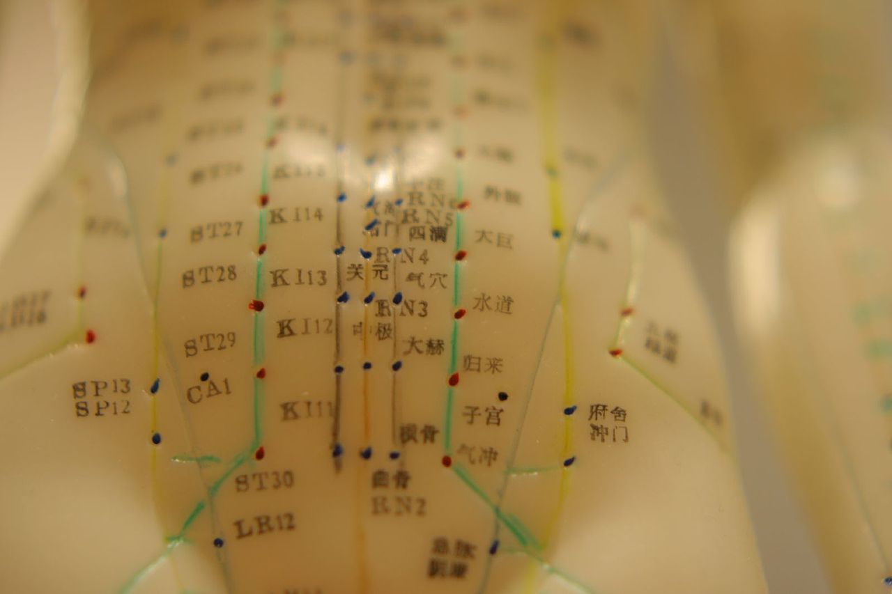 holistic medicine acupuncture